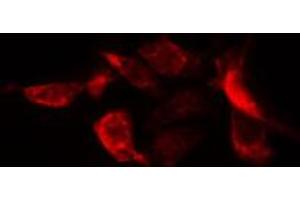 ABIN6274752 staining HuvEc cells by IF/ICC. (RPS20 antibody  (Internal Region))