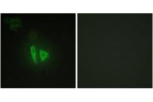 Immunofluorescence analysis of HepG2 cells, using AKAP11 Antibody.