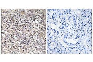 Immunohistochemistry (IHC) image for anti-Claudin 6 (CLDN6) (Internal Region) antibody (ABIN1851126) (Claudin 6 antibody  (Internal Region))