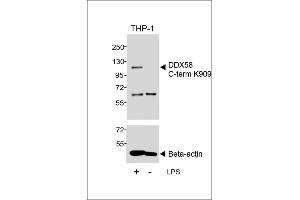 Western blot analysis of lysates from THP-1 cell line, untreated or treated with LPS, 1 μg/mL, using DDX58 C-term (upper) or Beta-actin (lower).