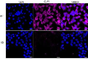 anti-CAP-GLY Domain Containing Linker Protein 1 (CLIP1) antibody