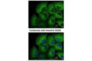 ICC/IF Image Immunofluorescence analysis of methanol-fixed H1299, using MMP12, antibody at 1:500 dilution. (MMP12 antibody)