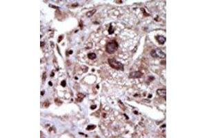 Image no. 1 for anti-serine threonine Kinase 39 (STK39) (Middle Region) antibody (ABIN360385) (STK39 antibody  (Middle Region))