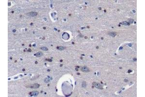 Detection of Grb7 in Porcine Cerebrum Tissue using Polyclonal Antibody to Growth Factor Receptor Bound Protein 7 (Grb7) (GRB7 antibody  (AA 66-327))
