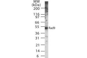 Image no. 1 for anti-RAD9 Homolog A (S. Pombe) (RAD9A) antibody (ABIN208030) (RAD9A antibody)