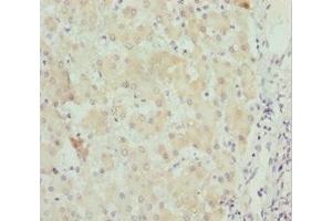 Immunohistochemistry of paraffin-embedded human liver tissue using ABIN7171258 at dilution of 1:100 (STXBP2 antibody  (AA 1-280))