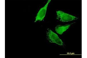 Immunofluorescence of purified MaxPab antibody to BCKDK on HeLa cell. (BCKDK antibody  (AA 1-412))