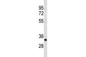 PLP antibody western blot analysis in mouse cerebellum tissue lysate (PLP1 antibody  (AA 248-277))