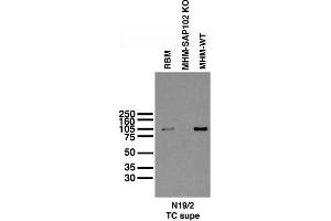 Immunoblot versus adult rat brain membranes (RBM), and adult mouse hippocampal membranes (MHM) from SAP102 knockout and WT mice (mouse samples courtesy of Dr.