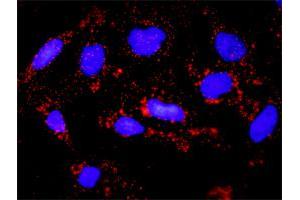 Proximity Ligation Assay (PLA) image for anti-Tumor Protein P53 (TP53) (AA 1-393) antibody (ABIN521045)