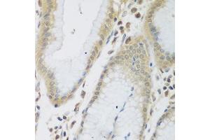 Immunohistochemistry of paraffin-embedded human stomach using ENPEP antibody  at dilution of 1:200 (40x lens). (ENPEP antibody  (AA 708-957))