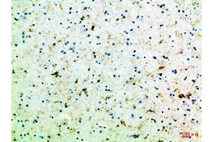 Immunohistochemical analysis of paraffin-embedded Human-brain, antibody was diluted at 1:100 (FZD4 antibody  (AA 11-60))