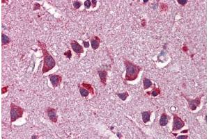 Human Brain, Cortex: Formalin-Fixed, Paraffin-Embedded (FFPE) (Neuregulin 3 antibody  (AA 540-589))