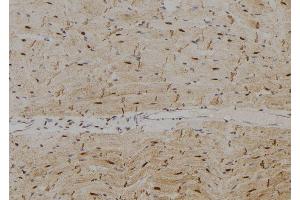 ABIN6265270 and ABIN6278780 at 1/100 staining Rat heart tissue by IHC-P.