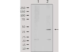 Western blot analysis of extracts from mouse brain, using AIM2 Antibody. (AIM2 antibody  (Internal Region))