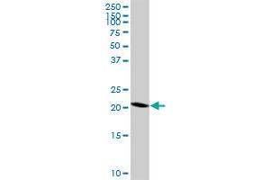 RNF182 polyclonal antibody (A01), Lot # 060802QCS1. (RNF182 antibody  (AA 1-99))