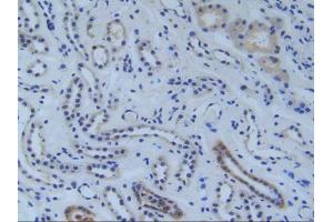 Figure. (RFTN1 antibody  (AA 288-520))