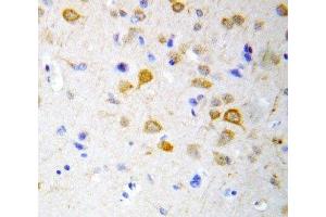 IHC-P: 5HT2A Receptor antibody testing of rat brain tissue (HTR2A antibody  (C-Term))