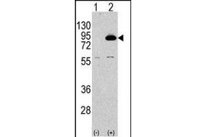 Western blot analysis of PIK3R2 Antibody (N-term) polyclonal antibody (ABIN392580 and ABIN2842115) (arrow). (PIK3R2 antibody  (N-Term))