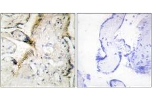 Immunohistochemistry analysis of paraffin-embedded human placenta tissue, using LAMA2 Antibody. (Laminin antibody  (AA 2011-2060))