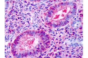 Anti-ESRRB / ERR-Beta antibody IHC of human uterus, endometrial glands. (ESRRB antibody  (N-Term))