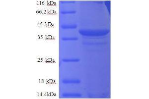 Cytochrome b5 (CYTB5) (AA 2-97), (partial) protein (GST tag)