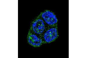 Confocal immunofluorescent analysis of FAS Antibody (Center) (ABIN652469 and ABIN2842320) with T47D cell followed by Alexa Fluor 488-conjugated goat anti-rabbit lgG (green). (FAS antibody  (AA 185-211))