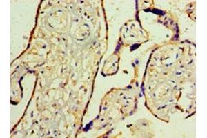 Immunohistochemistry of paraffin-embedded human placenta tissue using ABIN7175818 at dilution of 1:100 (WT1 antibody  (AA 1-449))
