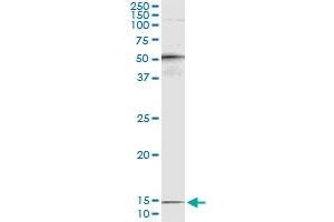 Immunoprecipitation of PTH transfected lysate using mouse monoclonal anti-PTH and Protein A Magnetic Bead (PTH (Human) IP-WB Antibody Pair)