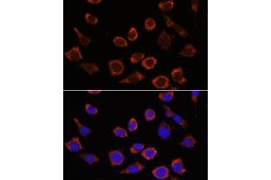 Immunofluorescence analysis of L929 cells using RPL35 antibody (ABIN7270004) at dilution of 1:100. (RPL35 antibody  (AA 50-120))
