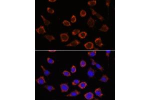 Immunofluorescence analysis of L929 cells using RPL35 antibody (ABIN7270004) at dilution of 1:100.