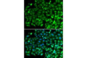 Immunofluorescence analysis of A549 cell using SH3GLB1 antibody. (SH3GLB1 antibody)