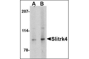 Western blot analysis of Slitrk4 in mouse brain tissue lysate with this product at (A) 0.