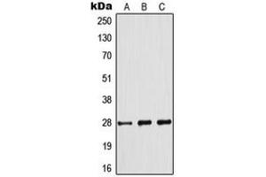 Western blot analysis of BCL2 (pS70) expression in Jurkat (A), THP1 (B), A2780 (C) whole cell lysates. (Bcl-2 antibody  (pSer70))