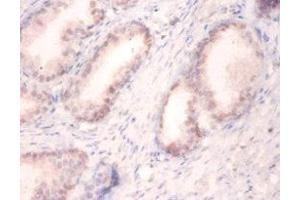 Immunohistochemistry of paraffin-embedded human prostate tissue using ABIN7174131 at dilution of 1:100 (SNRPA1 antibody  (AA 8-278))