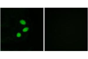 Immunofluorescence analysis of MCF7 cells, using TSH2 Antibody.