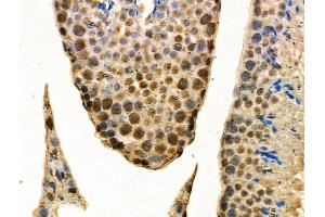 ABIN6257258 and ABIN6274281 at 1/100 staining Mouse testis tissue by IHC-P.