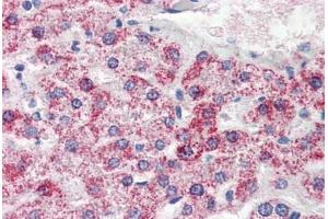 Human Liver (formalin-fixed, paraffin-embedded) stained with PSPH antibody ABIN364329 at 10 ug/ml followed by biotinylated anti-mouse IgG secondary antibody ABIN481714, alkaline phosphatase-streptavidin and chromogen. (PSPH antibody  (AA 1-225))
