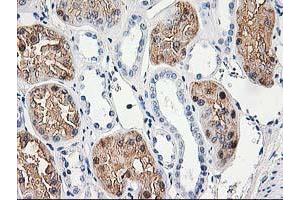 Immunohistochemistry (IHC) image for anti-Aminoacylase 1 (ACY1) antibody (ABIN1496453) (Aminoacylase 1 antibody)