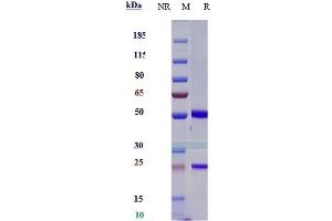 Anti-CD47 Reference Antibody (lemzoparlimab) on SDS-PAGE under reducing (R) condition. (Recombinant CD47 (Lemzoparlimab Biosimilar) antibody)