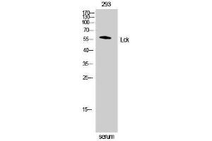 Western Blotting (WB) image for anti-Lymphocyte-Specific Protein tyrosine Kinase (LCK) (Ser738), (Ser742) antibody (ABIN3180148) (LCK antibody  (Ser738, Ser742))
