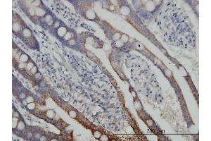 Immunoperoxidase of monoclonal antibody to DLD on formalin-fixed paraffin-embedded human small Intestine. (DLD antibody  (AA 1-509))