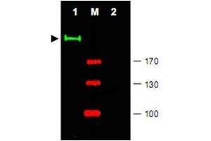 Western blot using Gli2 polyclonal antibody  shows detection of a predominant band at ~190 KDa corresponding to Gli2 (arrowhead) in mouse brain tissue lysate (Lane 1). (GLI2 antibody  (Internal Region))