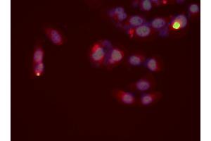 Immunofluorescence (fixed cells) (IF/ICC) image for anti-Toll-Like Receptor 8 (TLR8) (C-Term) antibody (ABIN6265604)