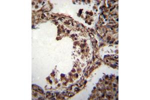 TUBA1C Antibody (C-term) (ABIN655982 and ABIN2845366) immunohistochemistry analysis in formalin fixed and paraffin embedded human lung tissue followed by peroxidase conjugation of the secondary antibody and DAB staining.