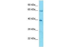 Host:  Rabbit  Target Name:  KLHL12  Sample Type:  Stomach Tumor lysates  Antibody Dilution:  1. (KLHL12 antibody  (N-Term))