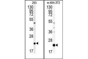 Image no. 1 for anti-Phosphatidylethanolamine Binding Protein 1 (PEBP1) (Middle Region) antibody (ABIN360564) (PEBP1 antibody  (Middle Region))
