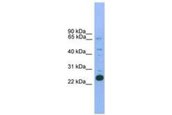 NKX2-6 antibody  (AA 74-123)