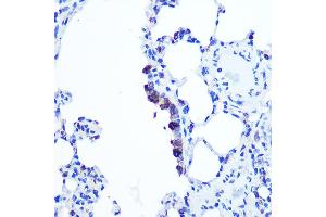 Immunohistochemistry of paraffin-embedded Rat lung using TOP1MT Rabbit pAb (ABIN7270851) at dilution of 1:100 (40x lens). (TOP1MT antibody  (AA 470-550))