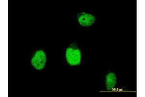 Immunofluorescence of monoclonal antibody to BLM on HeLa cell. (BLM antibody  (AA 1196-1295))
